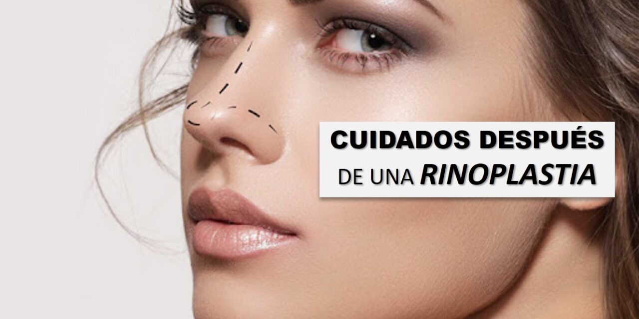 Rinoplastia, guía para tus cuidados postoperatorios