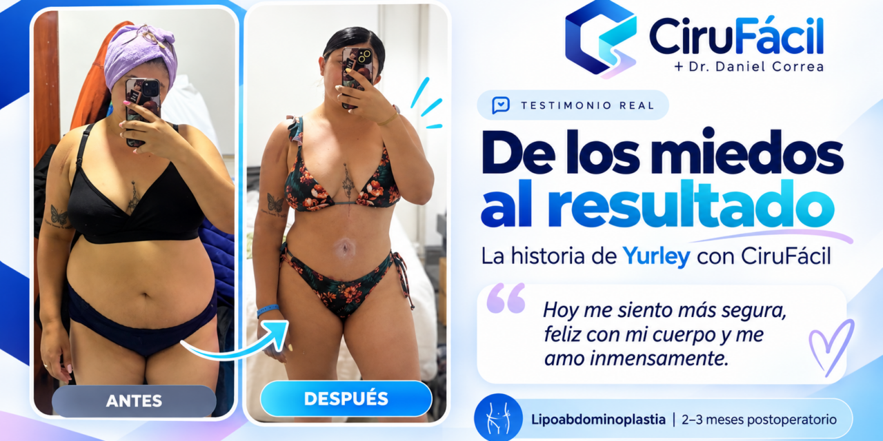 “¿Y el dolor?, ¿la cicatriz?, ¿cómo voy a cuidar a mi bebé?”: los miedos de Yurley antes de su lipoabdominoplastia