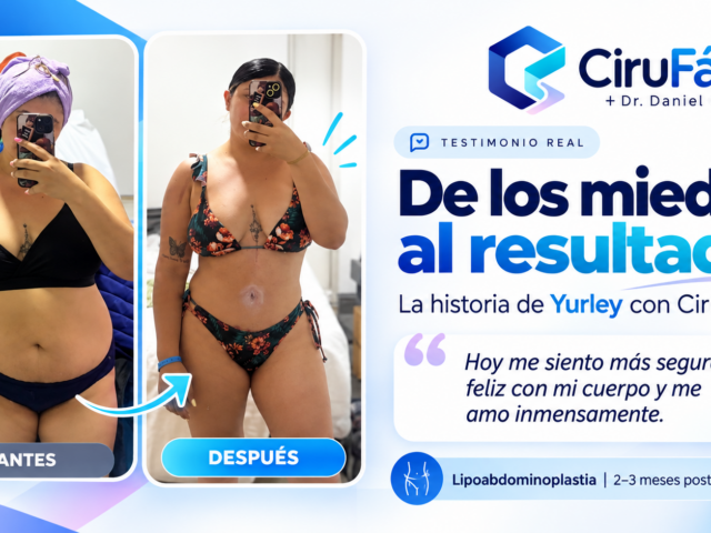 “¿Y el dolor?, ¿la cicatriz?, ¿cómo voy a cuidar a mi bebé?”: los miedos de Yurley antes de su lipoabdominoplastia